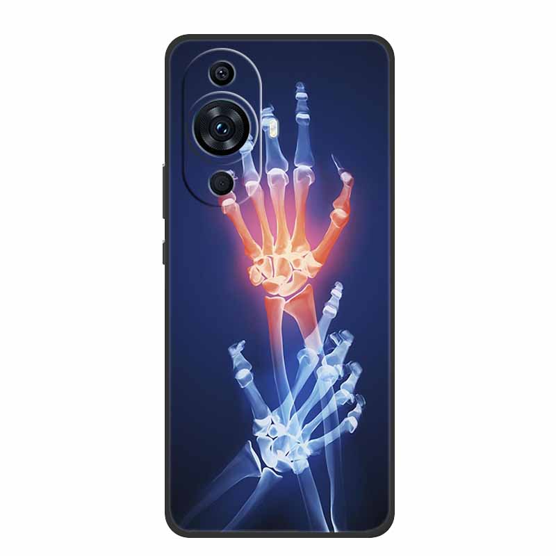 For Huawei Nova 12s Case Nova1 - Huawei Nova 12 recension och pris